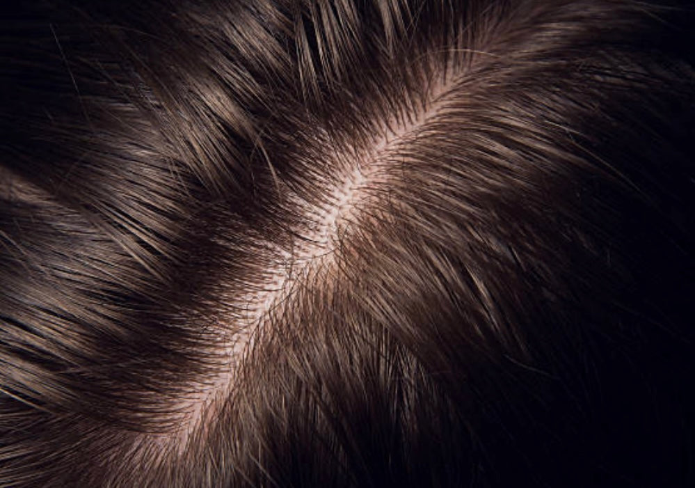 Natuurlijke oliën voor hoofdhuid verzorging en haargroei - PurePure