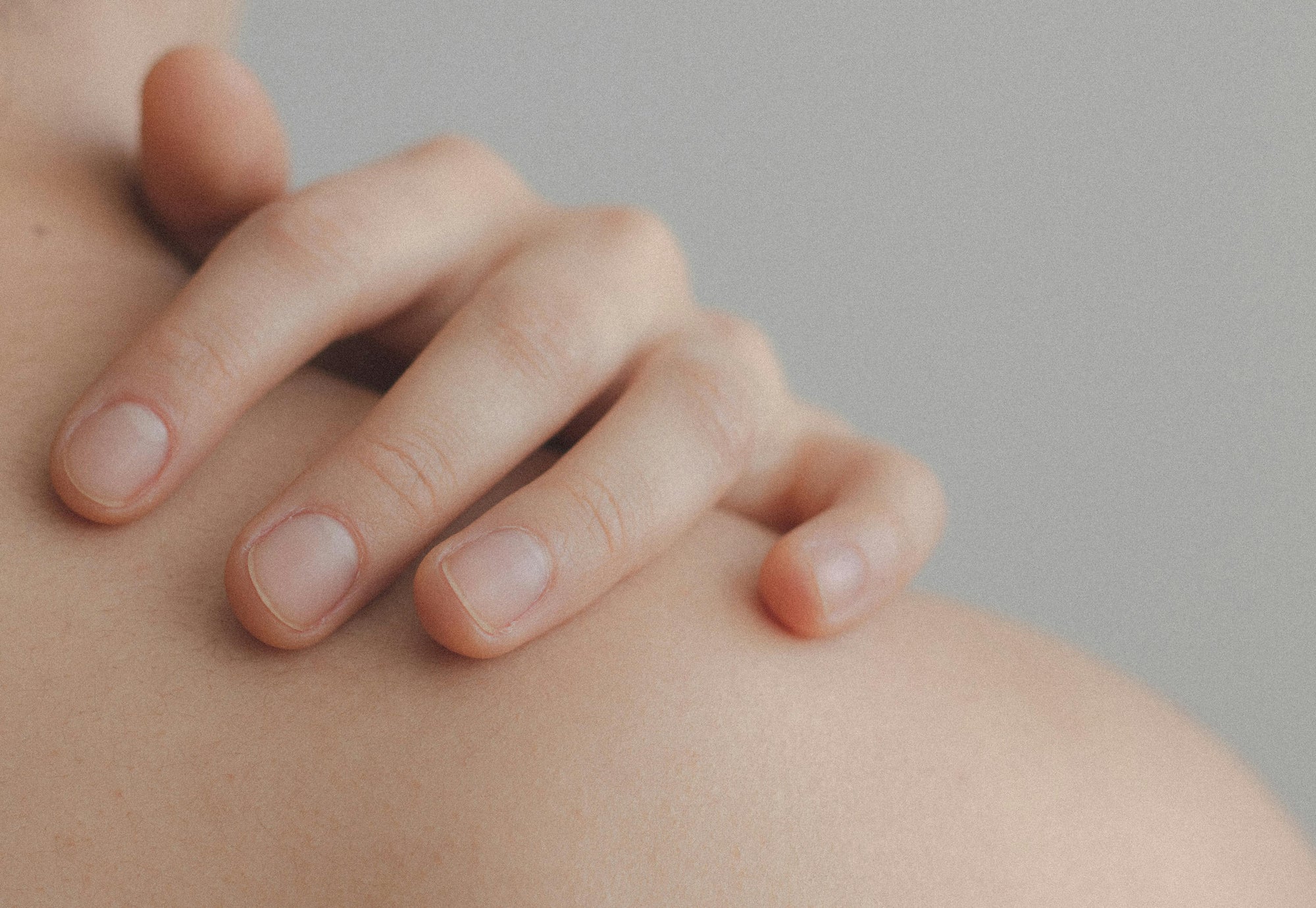 Stress is slecht voor de huid